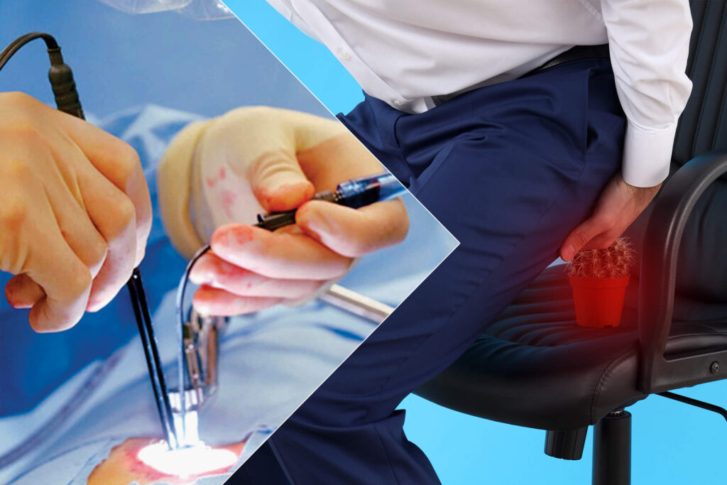 Treatment cost details for piles laser in Mashhad